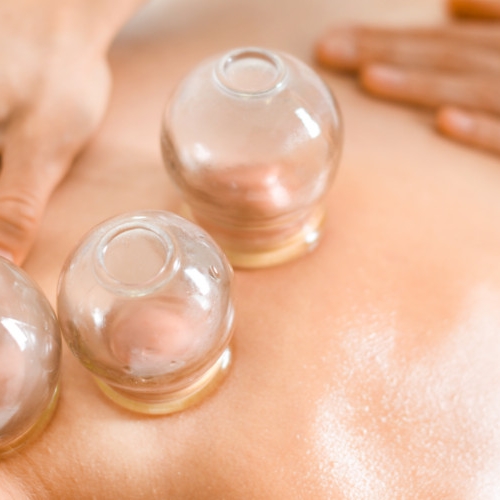 Cupping-Ellis-Physical-Therapy-Idaho-Falls-ID